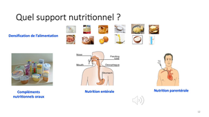 L.AS 3 - UE 64 - Nutrition - Dénutrition