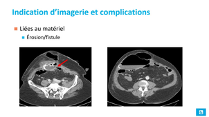 session 1 cours 4-5 imagerie