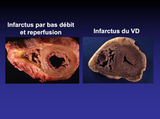 DFGSM2 - Substrats anatomiques des maladies cardiovasculaires (Partie 1)