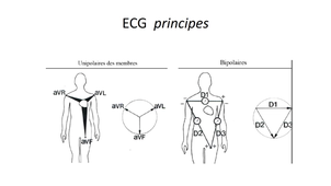 DFGSM2 - MED0308 - Sémiologie cardiologique - ECG