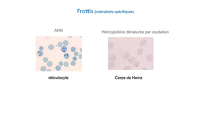 DFGSM2 / DFGSMa2 - MED0304 - Hématies - Morphologie érythrocytaire