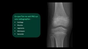 DFGSM2 - MED0308 - Sémiologie radiologique - Radiologie