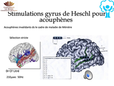 Chirurgie et personnes en situation de handicap