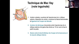 DPC-bassini-macvay