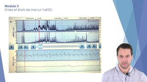Module 3 - Crises et états de mal sur l'aEEG