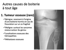 les boiteries non febriles (item B)