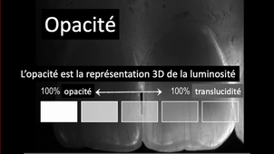 Composites dentaires vidéo 5 : Les substances cosmétiques dans la matrice