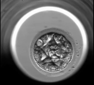 L.AS SpS - UE 24 - EC3 : Biologie de la reproduction et Embryologie - Embryoscope