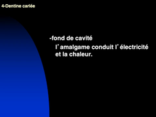 finition des parois