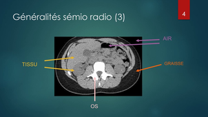 Radiologie P1V1