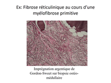 DFGSM3 - MED0602 - Pathologie inflammatoire - Inflammation chronique et fibrose