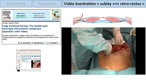 session 3 cours 5 sublay