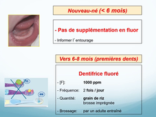 UE44 EC2 Odontologie Prendre soin des dents de l'enfant