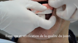 PAC_EAF maxillaire_Enregistrement des bords