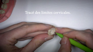 Bloc technique sur 36
