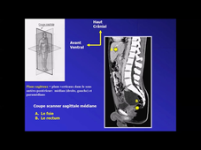 PASS / L.AS - UE 11 - Anatomie - Introduction : généralités  orientation dans l'espace