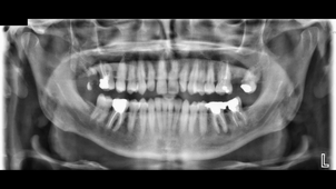 TD imagerie médicale