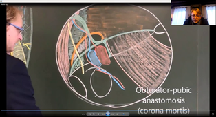 hernies et anatomie de la paroi abdominale 2