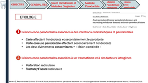 classification des maladies parodontales