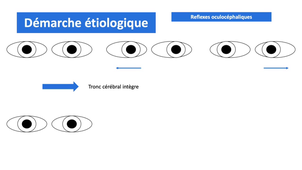DFGSM2 - MED0308 - Sémiologie neurologique - Coma et troubles de la conscience