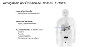 DFGSM2 - MED0308 - Sémiologie radiologique - Tomographie par Emission de Positons (TEP)