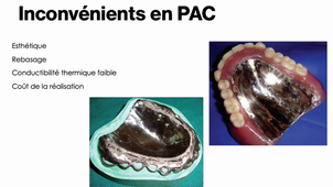 Chapitre 2 : Alliages dentaires partie 5