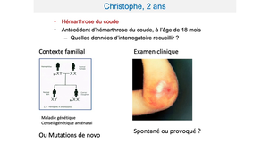 DFGSM2 / DFGSMa2 - MED0304 - Reconnaître et interpréter un syndrome hémorragique - Hémophilie