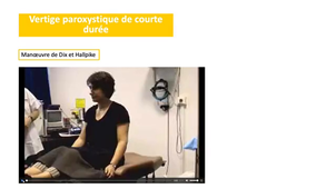 DFGSM2 - MED0308 - Sémiologie neurologique - Troubles de l'équilibre / Vertiges et sensations vertigineuses
