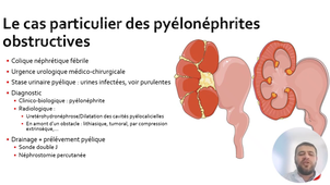 ITEM 161 INFECTIONS URINAIRES