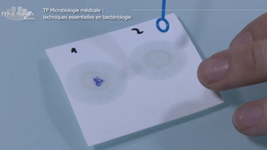 Vidéo 5 - Les tests biochimiques  2 : l'oxydase