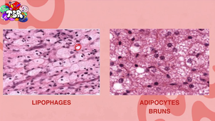 UE13 - Histologie - Les tissus conjonctifs - Par Noura-Houda Feroui