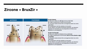 Chapitre 4P2 céramique cfao