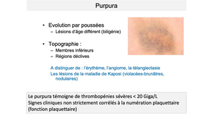 DFGSM2 / DFGSMa2 - MED0304 - Reconnaître et interpréter un syndrome hémorragique - Généralités