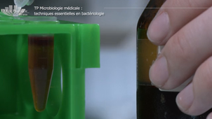 Vidéo 6 - Les tests biochimiques  3 : les tests uréase-indole-TDA