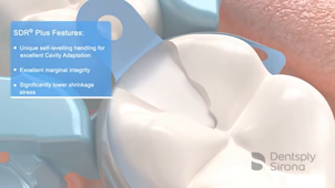 matrice palodent