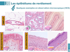 UE13 - Cours n°2 - Le tissu épithélial - partie 2 - L'épithélium de revêtement