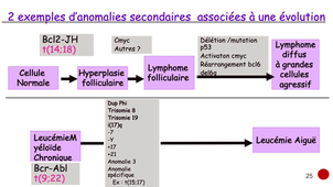 DFGSM2 / DFGSMa2 - MED0304 - Leucémogenèse : caractéristiques des anomalies de l'ADN et leurs conséquences