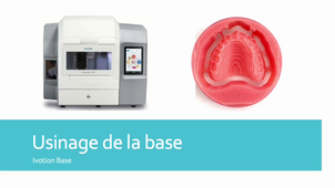 Résines chapitre 2-1 : Autres mises en oeuvre des résines pour base prothétique