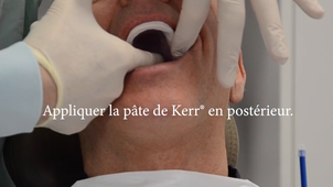 PAC_EAF maxillaire_Enregistrement du JVP