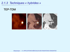 PASS / L.AS - Semestre 1 - UE 11 - Biophysique - Applications medicales des radiations ionisantes (partie 2 - médecine nucléaire)