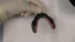 Prolongation PEC mandibulaire