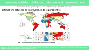 CES de PArodontologie - épidémiologie des maladies parodontales