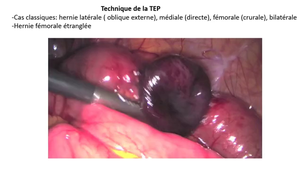 Session 1 cours 9 TEP