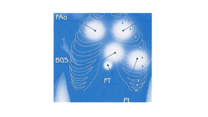 DFGSM2 - MED0308 - Sémiologie cardiologique - Examen clinique : auscultation artérielle et cardiaque