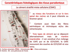 PASS / L.AS - UE 21 - EC 5 - Le parodonte : le cément