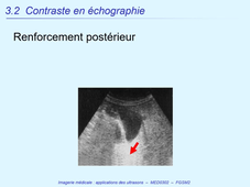 DFGSM2 - MED0302 - Imagerie Médicale - Imagerie échographique